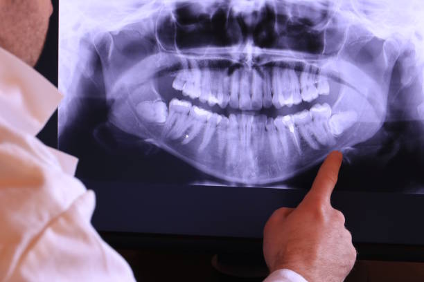 Best Tooth Pain Emergency Relief  in Winter Beach, FL